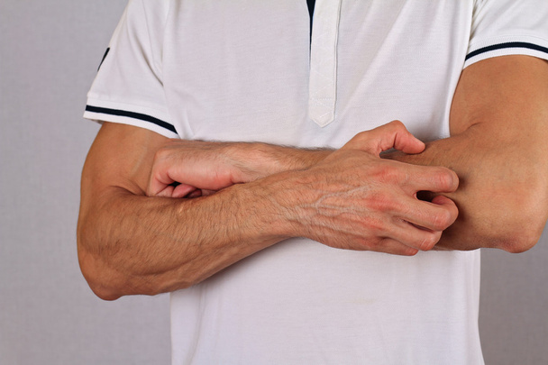 Man Scratching an itch. Skin,Allergic Reaction, Irritation - Φωτογραφία, εικόνα