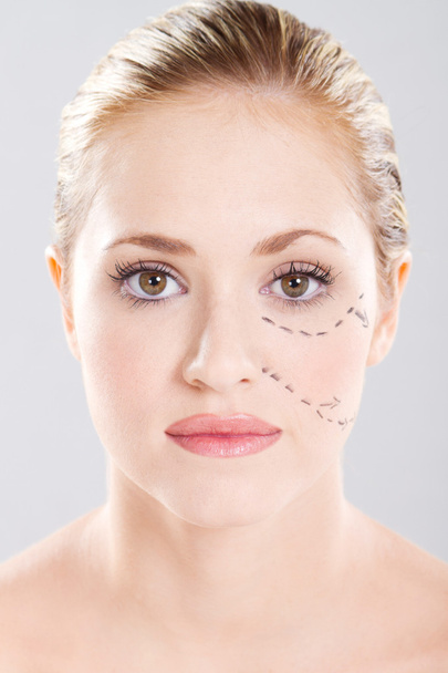 Woman face marked with lines for cosmetic surgery - Foto, Imagem