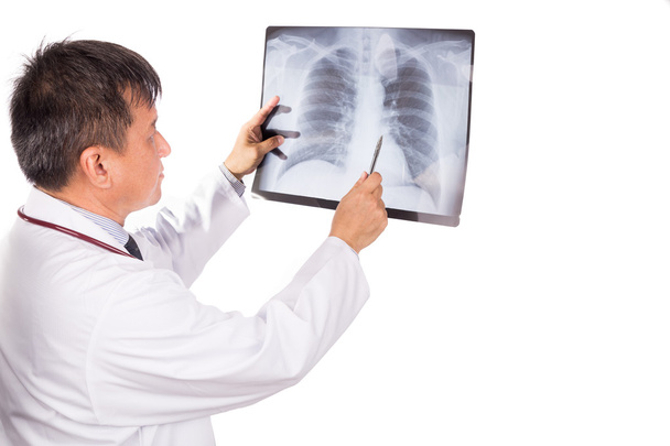 Matured Asian medical doctor examining lungs X-ray negative film - 写真・画像