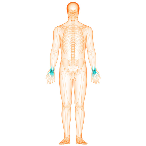 Ihmisen kehon nivelkivut
 - Valokuva, kuva