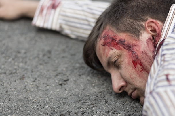 Injured man after car accident - Fotó, kép
