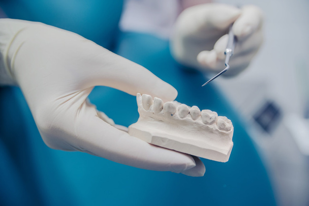 стоматолог в резиновых перчатках и с отлитыми зубами
  - Фото, изображение