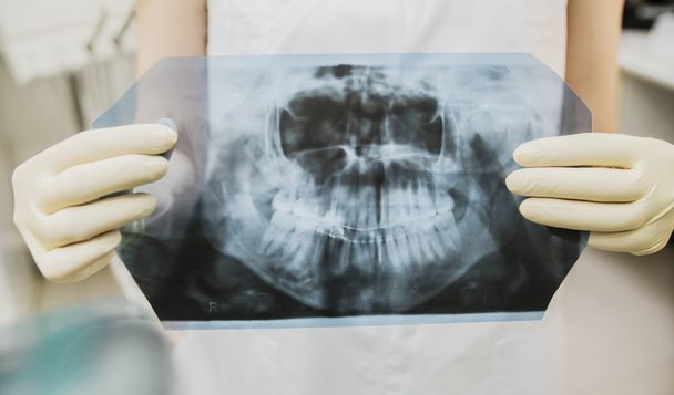 Doktor ruce v gumové rukavice drží lékařské RTG zubů a lebky zblízka  - Fotografie, Obrázek