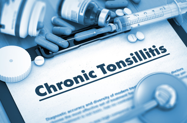 Chronische tonsillitis diagnose. Medisch concept. 3d. - Foto, afbeelding