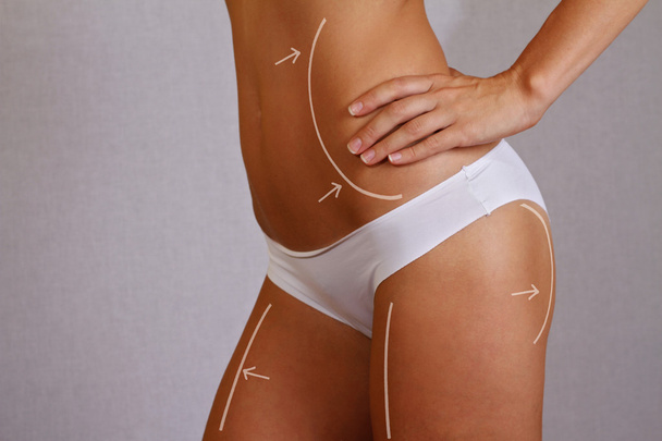 Woman Fat lose, liposuction and cellulite removal concept. Female body with Correction Lines / Arrows - Photo, Image