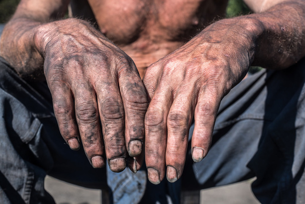 Worker Dirty Hands. - Photo, Image