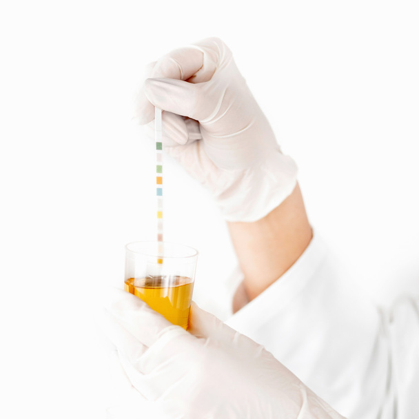 Analyzing urine sample - Photo, Image