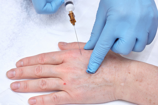 Anti-age injection therapy. Hand rejuvenation. - Photo, Image