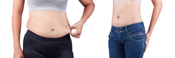 vientre de grasa corporal de las mujeres entre antes y después de la pérdida de peso
 - Foto, Imagen