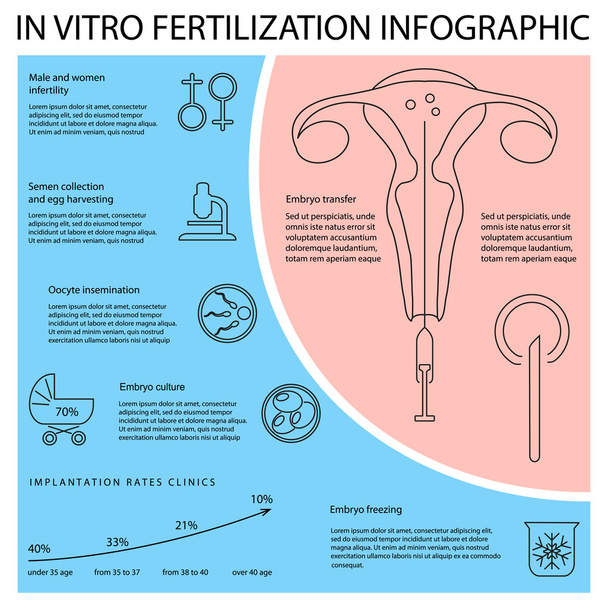 In vitro fertilization infographic. - Vector, Image