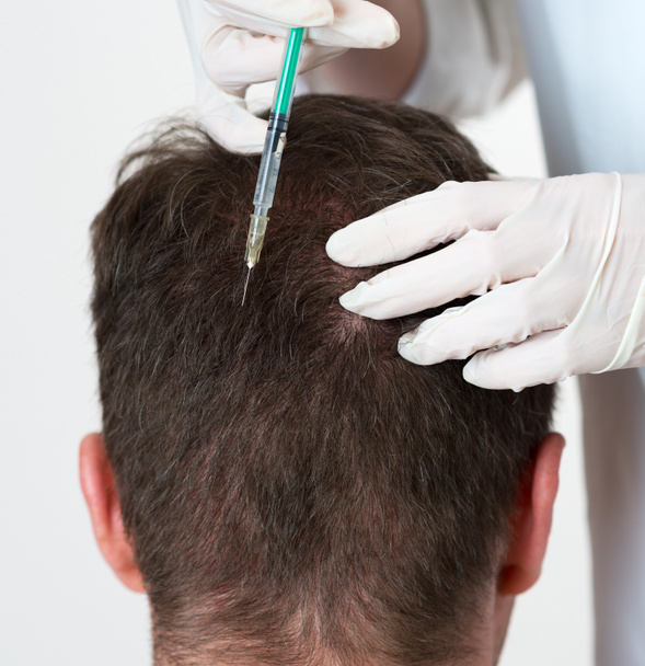 Un hombre guapo recibe una inyección en la cabeza. Concepto de Mesoterapia
. - Foto, imagen
