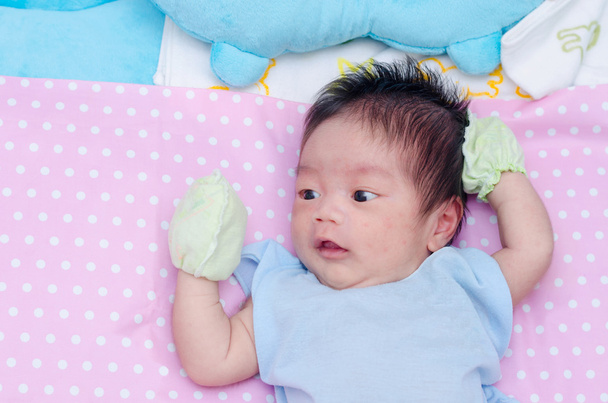 Маленький новонароджений з висипом на обличчі
 - Фото, зображення
