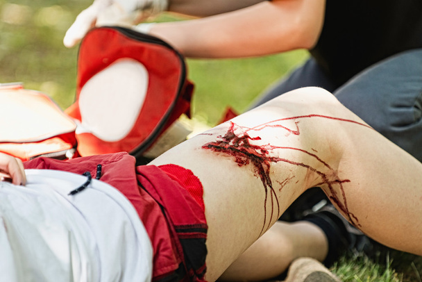 Záchranáře adresování zranění vážné nohy - Fotografie, Obrázek