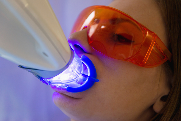 Teeth whitening procedure - Photo, Image