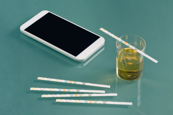 Urinprobe und Smartphone - Foto, Bild
