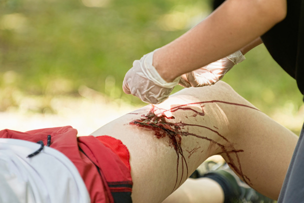 Putting gauze on injured leg - Photo, Image