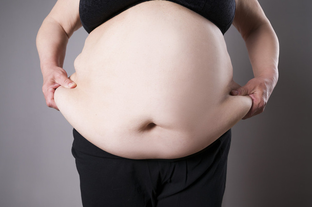 Obesity female body, fat woman belly close up - Φωτογραφία, εικόνα