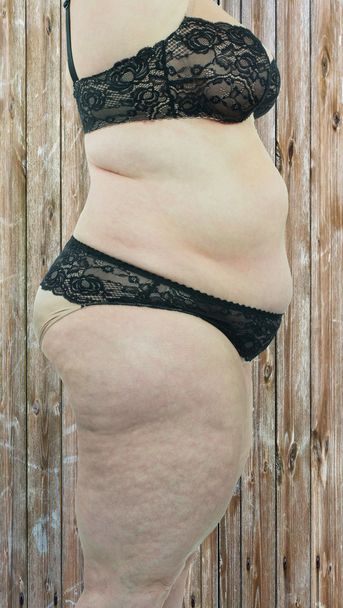Woman showing her cellulite - Zdjęcie, obraz