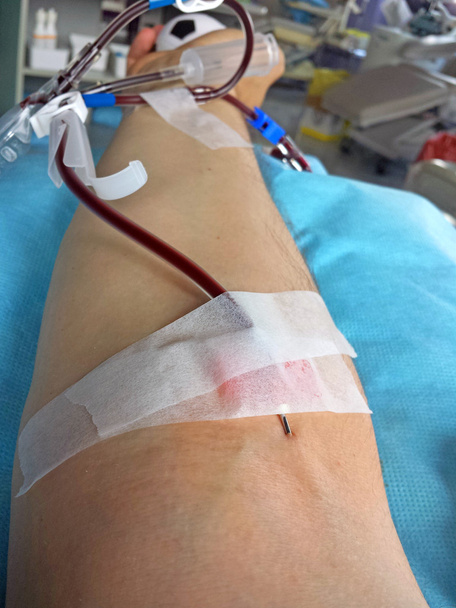 voluntário ao doar sangue na cama do hospital
 - Foto, Imagem