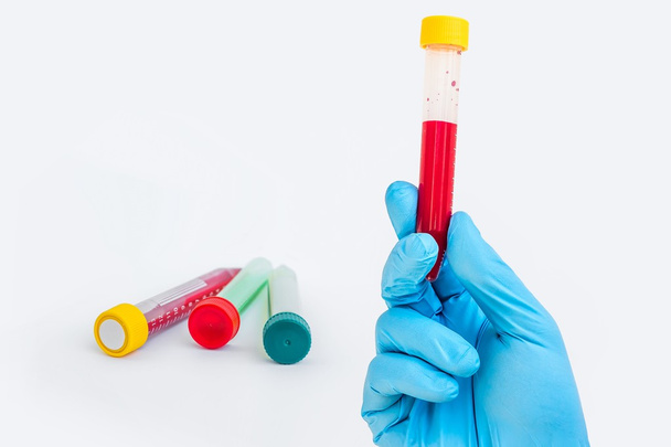Οι επιστήμονες χέρι που κρατά ένα δοκιμαστικό σωλήνα με αίμα - Φωτογραφία, εικόνα