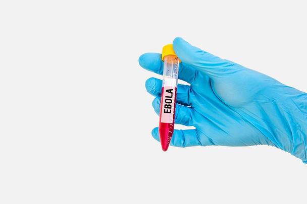 Próbówki z próbki krwi do badań Ebola - Zdjęcie, obraz