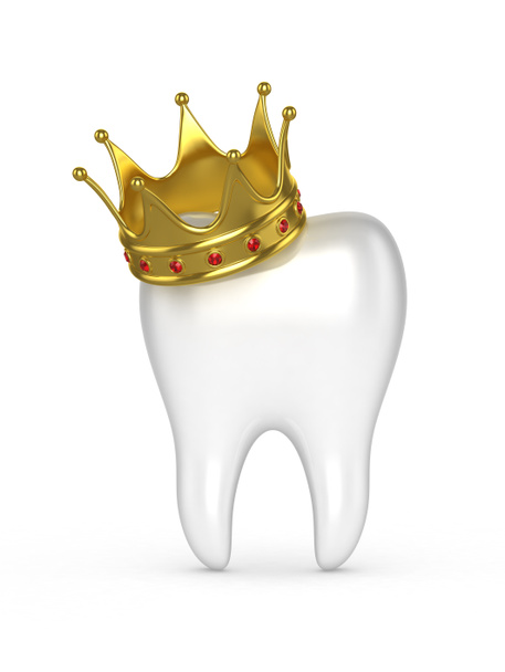 Ανθρώπινο δόντι με ένα χρυσό στέμμα σε λευκό φόντο.  - Φωτογραφία, εικόνα
