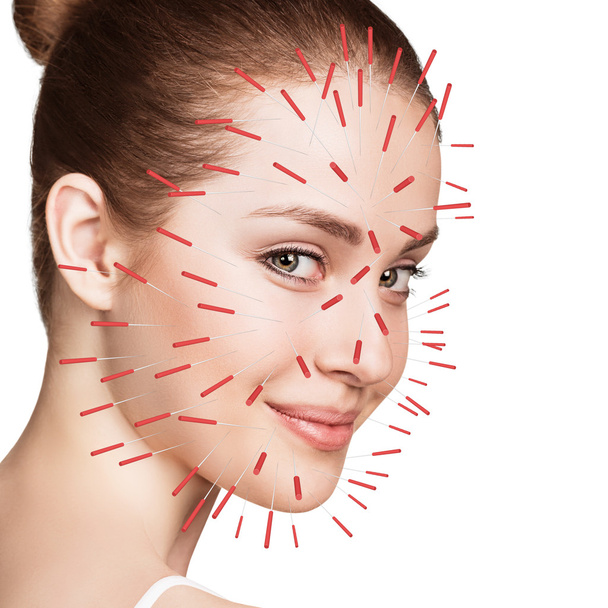 Zbliżenie: wykonywania terapii akupunktury na twarzy - Zdjęcie, obraz