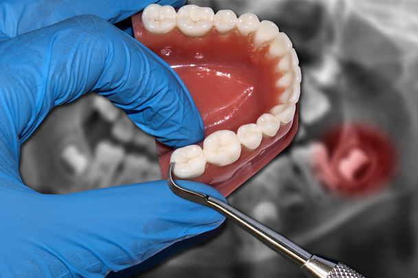 dentiste montrent molaire et sagesse contact dentaire
 - Photo, image