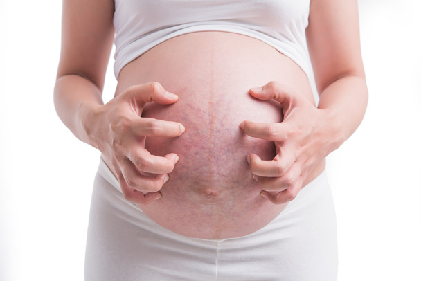 Pregnant women, stretch marks White background - Photo, Image