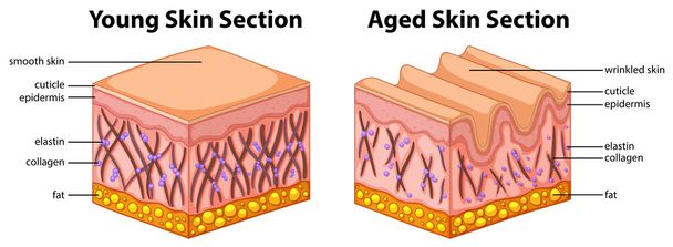 Diagrama que muestra piel joven y envejecida
 - Vector, Imagen