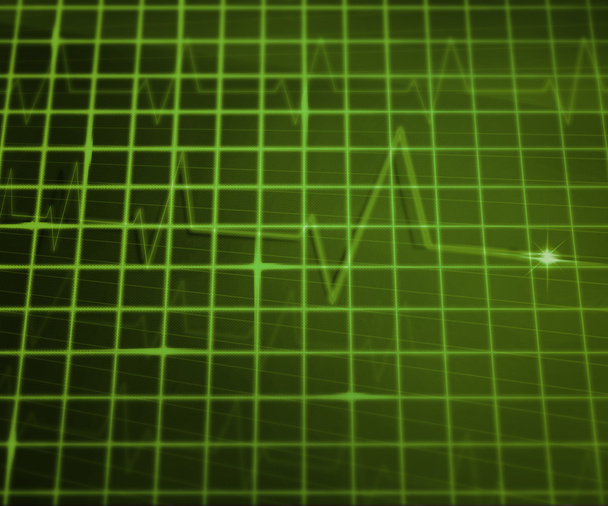 groene ekg medische achtergrond - Foto, afbeelding