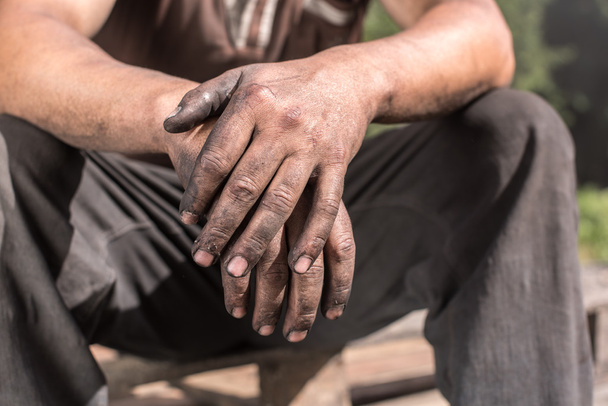 Worker Man with Dirty Hands. - 写真・画像