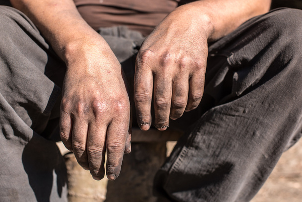 Worker Man with Dirty Hands. - Zdjęcie, obraz