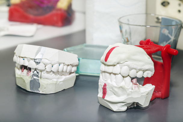 Technische schoten op een tandheelkundige prothetic laboratorium - Foto, afbeelding