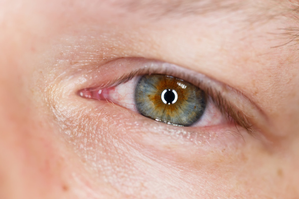 Occhio umano irritato primo piano
 - Foto, immagini