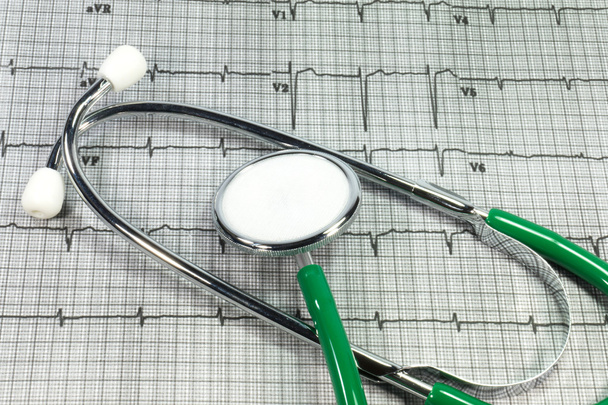 A stethoscope on an electrocardiogram - Photo, Image