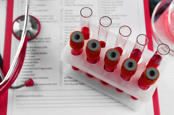 Blood samples in glass tubes - Φωτογραφία, εικόνα
