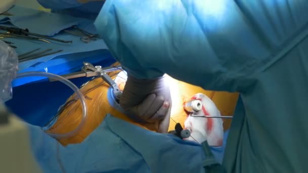 Cardiale interventie chirurgie - Video