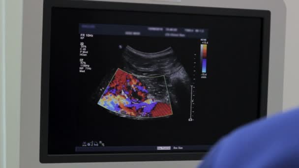 Los dispositivos de examen por ultrasonido monitorean el primer plano, colorean los órganos humanos
 - Imágenes, Vídeo