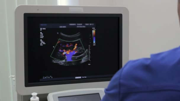 El médico muestra en el monitor Ultrasonografía examen de los vasos de color del árbol y la arteria renal
 - Imágenes, Vídeo