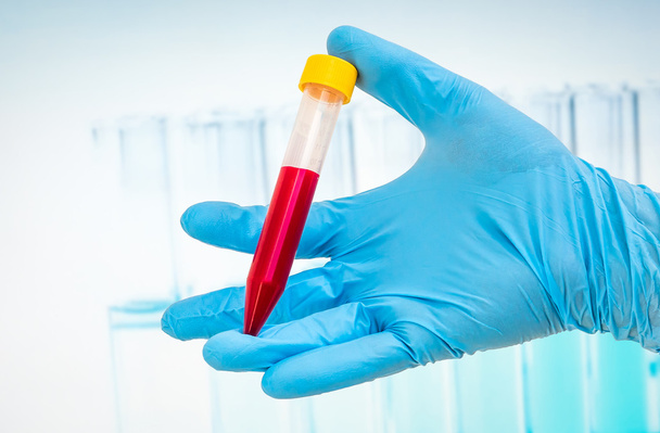 Test-tube with blood sample for BLOOD test - Fotó, kép