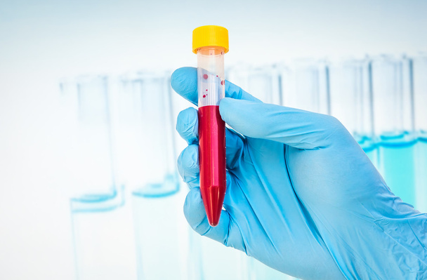 Test-tube with blood sample for BLOOD test - Zdjęcie, obraz