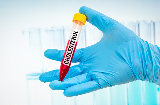 Test-tube with blood sample for CHOLESTEROL test - Photo, Image