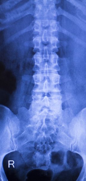 Neck and spine injury xray scan - Photo, Image