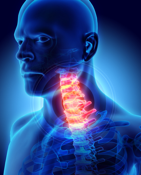 Neck painful - cervica spine skeleton x-ray, 3D illustration. - Фото, изображение