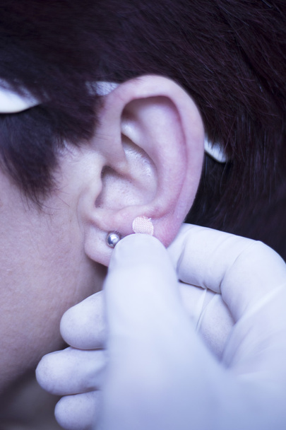 Аурикулярная терапия семенами ушей
 - Фото, изображение