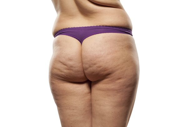 obese female buttocks - Photo, Image