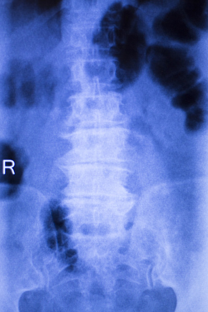 Exploración por rayos X del cuello y la columna vertebral
 - Foto, imagen