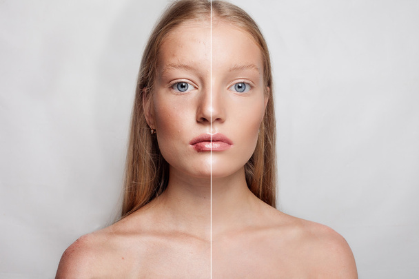 Before and after cosmetic operation. Young pretty woman portrait - Фото, зображення