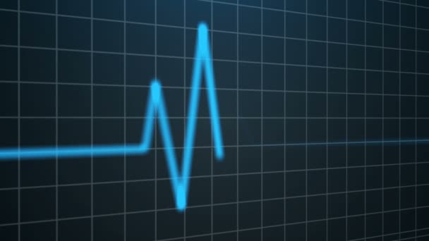 EKG. Szívverés-hullámok - Felvétel, videó